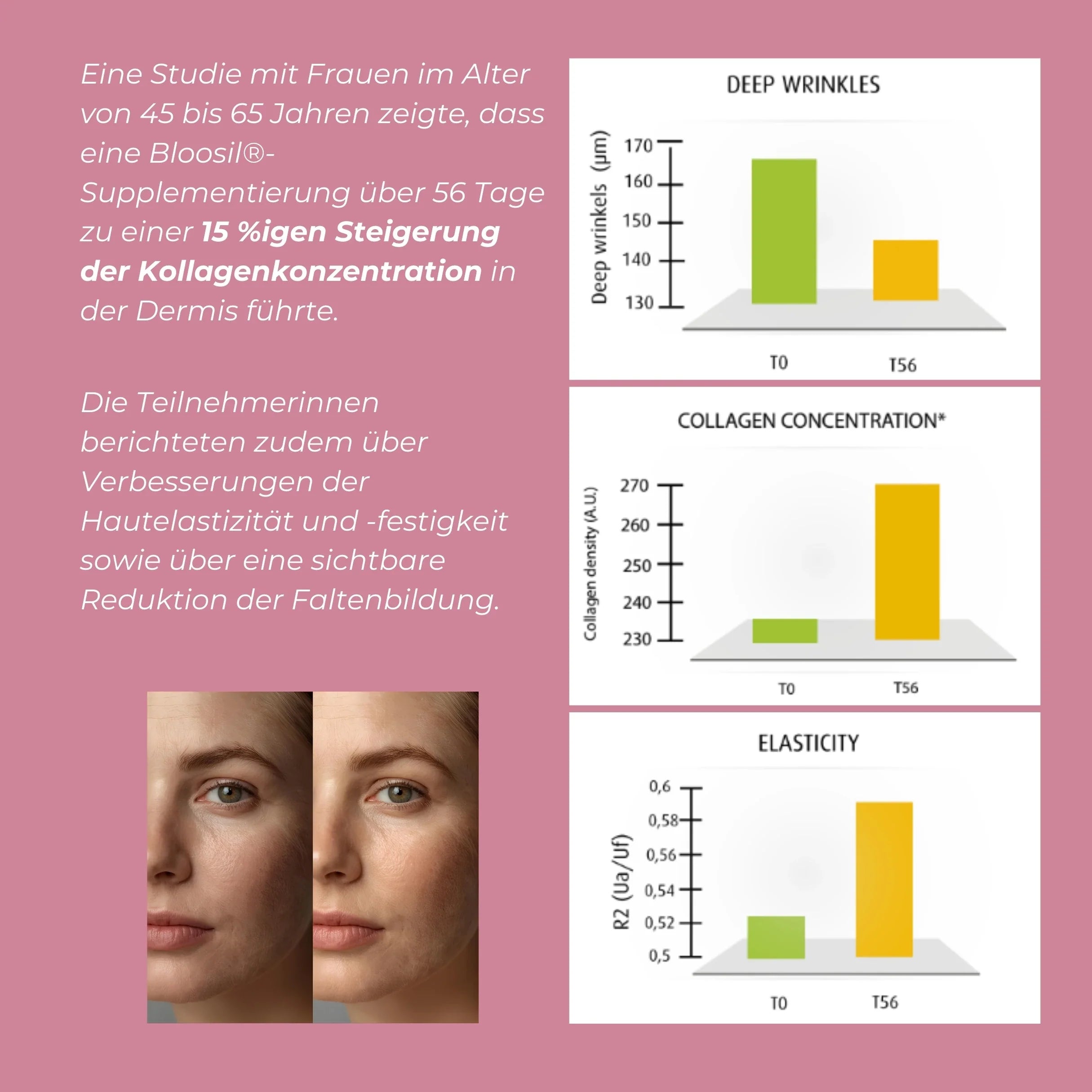 Silizium (Bloosil®)