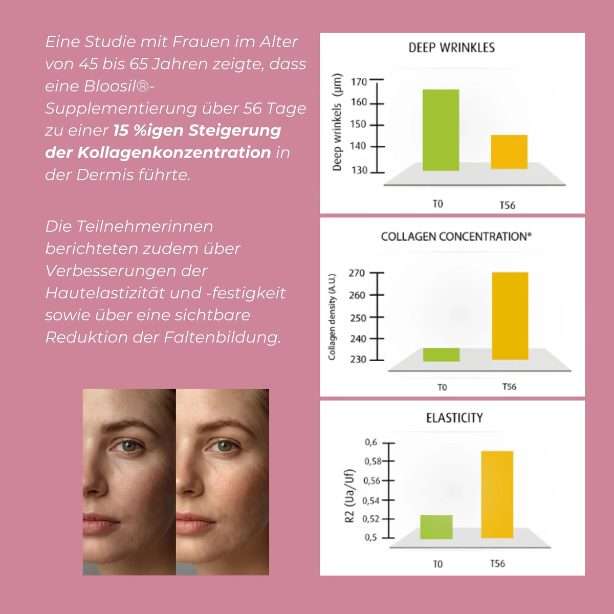 Silizium (Bloosil®)